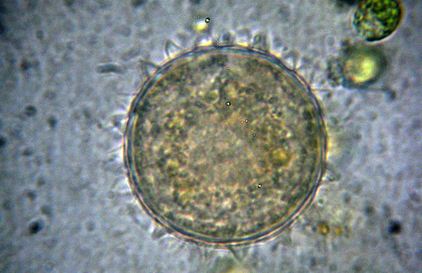 Resting cyst of Colpoda flavicans ???